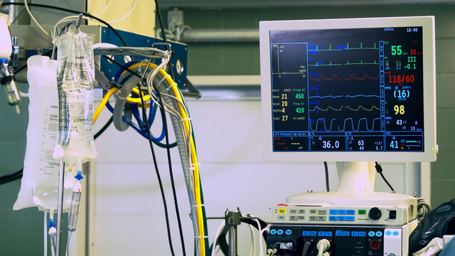 Cardiac Monitor in operating room